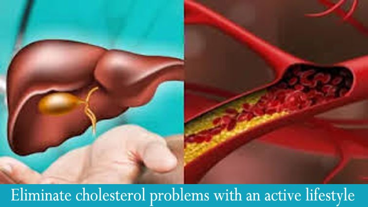 एक्टिव लाइफस्टाइल से दूर करें कोलेस्‍ट्रॉल की परेशानी