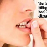 नाखून चबाने की आदत डाल सकती है गंभीर बीमारियों में, जानिए 5 बड़े नुकसान और समाधान