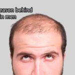 हार्मोन या जेनेटिक्स? पुरुषों में गंजेपन की असली वजह