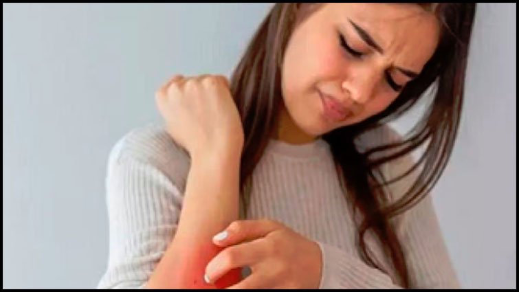 पित्त दोष बढ़ने से स्किन और पाचन पर असर: आयुर्वेदिक समाधान