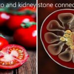 कौन सी पथरी में टमाटर खाना नुकसानदायक है?