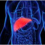 बिना दवा के फैटी लिवर से छुटकारा पाने के तरीके