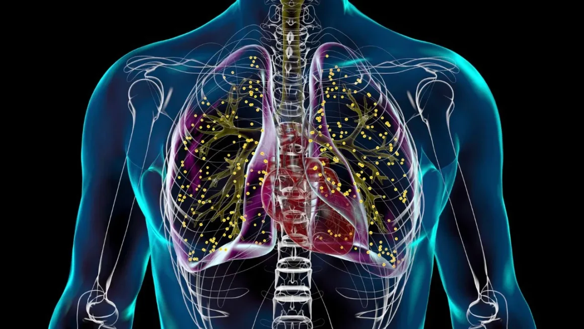 TB treatment: टीबी का इलाज बीच में छोड़ना पड़ सकता है भारी, जानें क्यों जरूरी है पूरा कोर्स