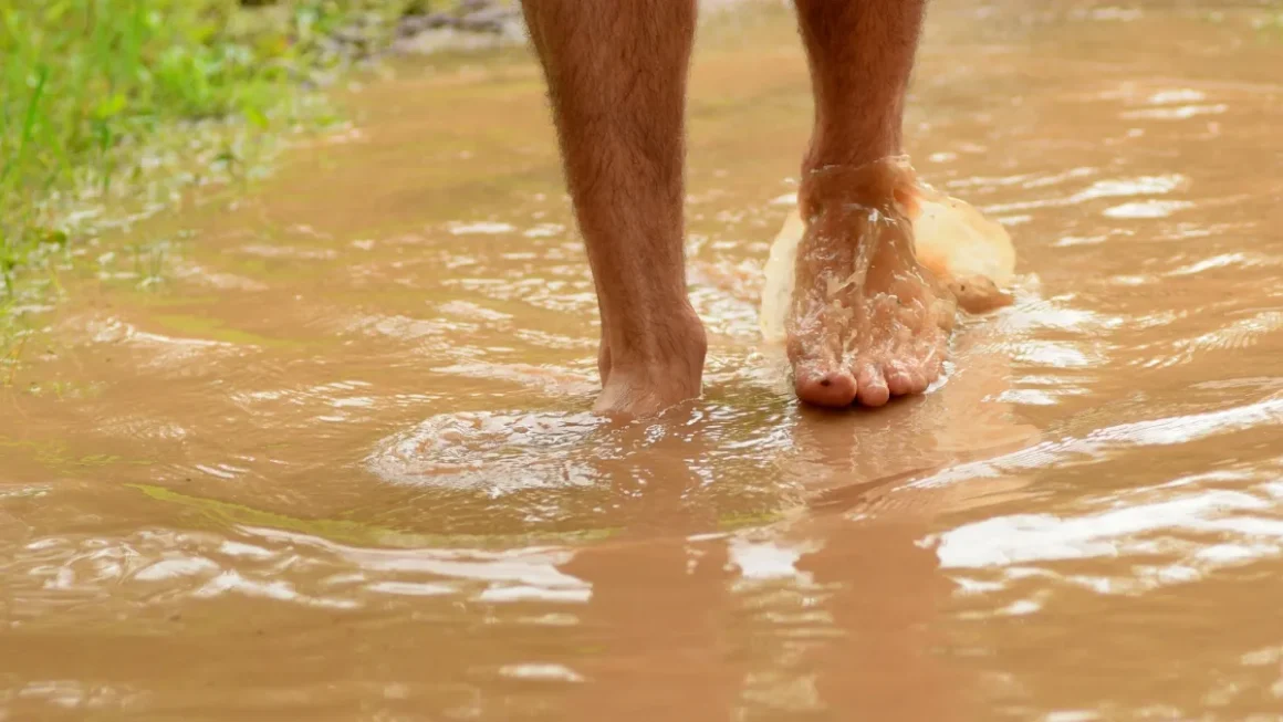 Monsoon Health Tips: बारिश के गंदे पानी में चलने से बढ़ सकता है संक्रमण, डॉक्टर से जानें बचाव