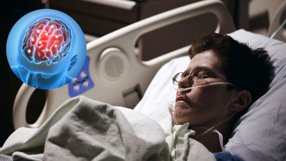 Young Age Stroke: कम उम्र में क्यों बढ़ रहे स्ट्रोक के मामले? न्यूरोलॉजिस्ट ने बताई बड़ी वजह
