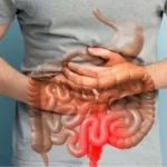 Sensitive Gut Foods