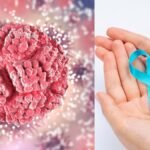Cancer Recurrence