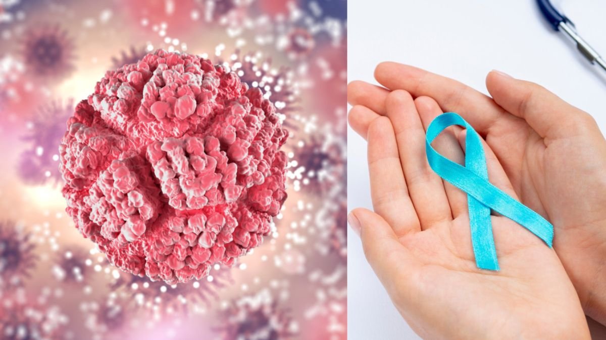 Cancer Recurrence