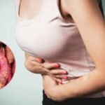 Sweet Potato for Constipation